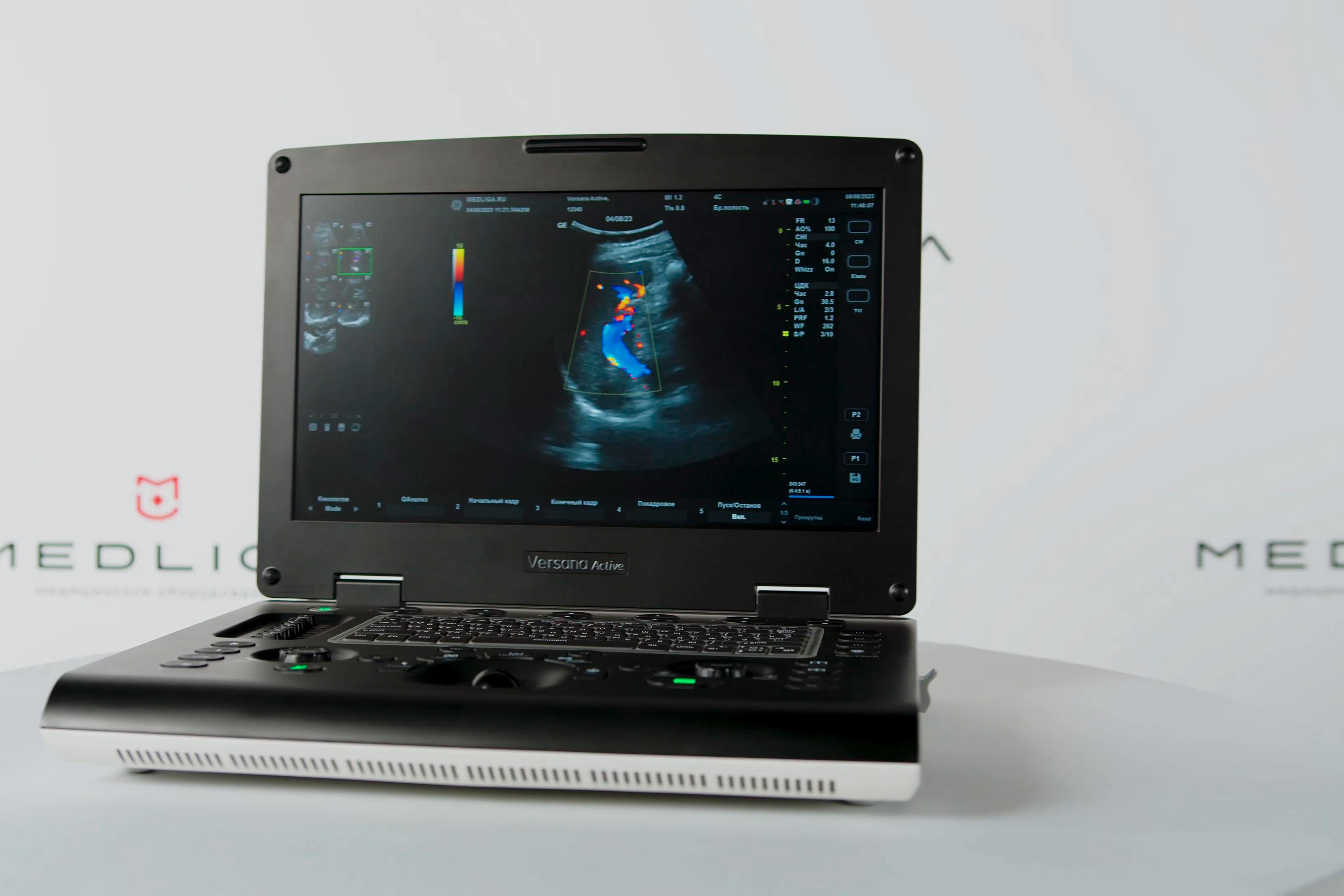 Видеообзор УЗ аппарата GE Versana Active