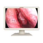 Olympus CV-170 (Optera), 3