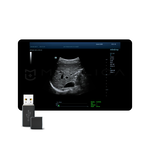 STQ (Sound Touch Quantification)